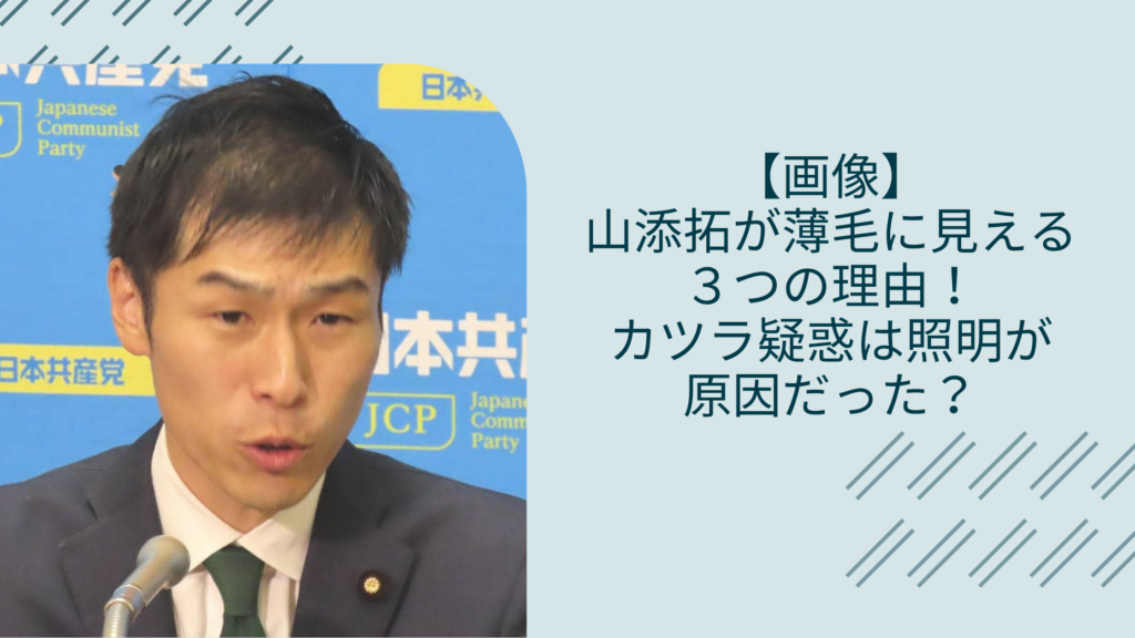 山添拓の薄毛に関する記事のアイキャッチ画像