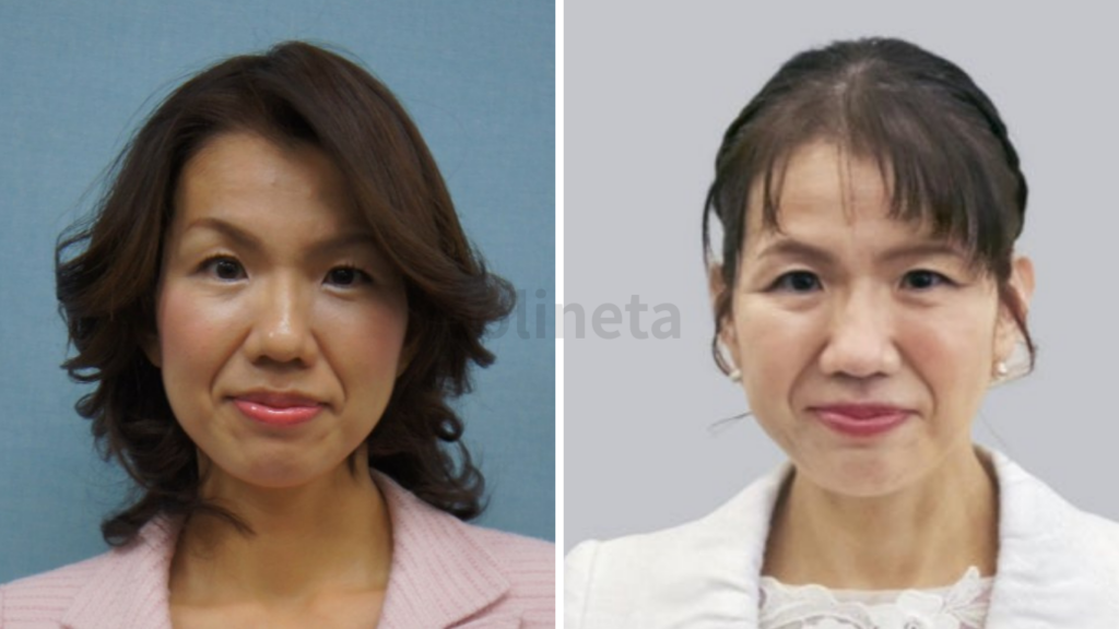 豊田真由子のメイクの変化